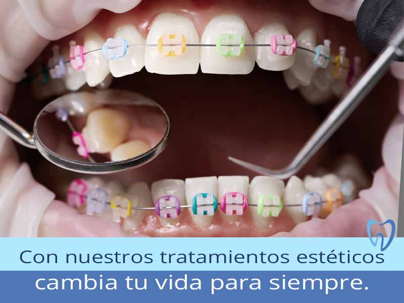 Clínica Dental en México